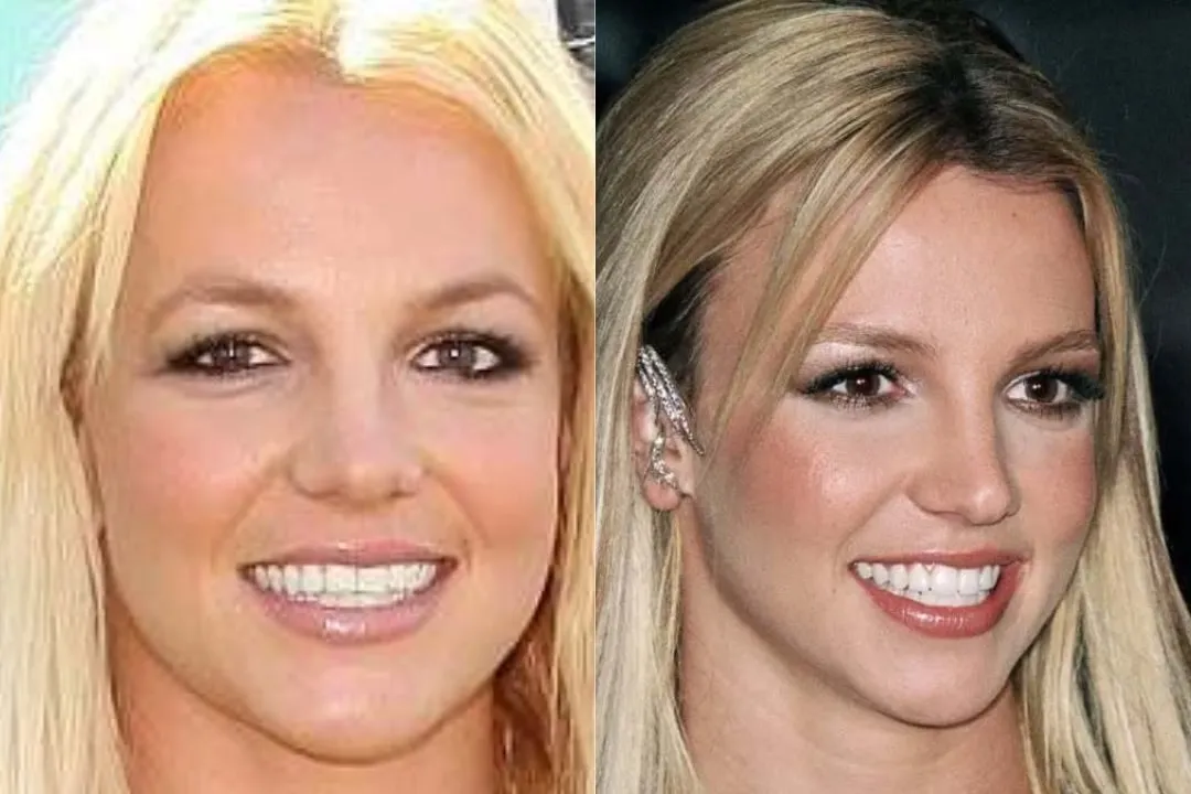 Britney Spears after dental work